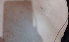 1 Year And 2 Months Estrodiol