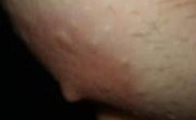 Breast