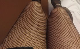 My Legs