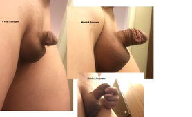 Stages Of Penile Feminization