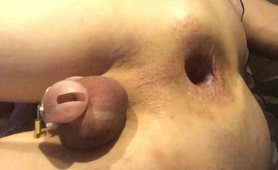 Anal Gaping Sissy