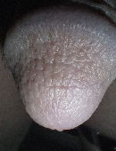 Analcunt69