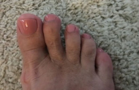 thumb