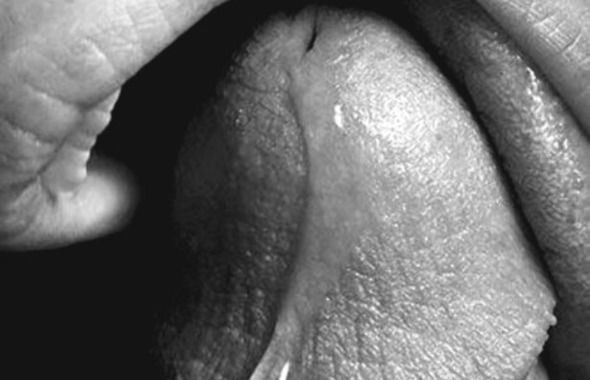 thumb