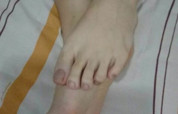 thumb