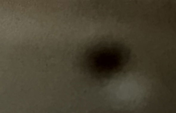 thumb