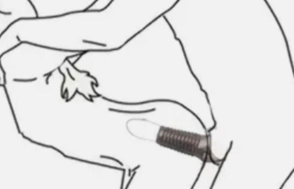thumb