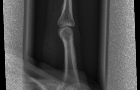 thumb