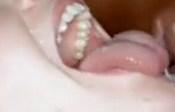 thumb