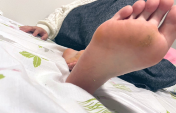 thumb