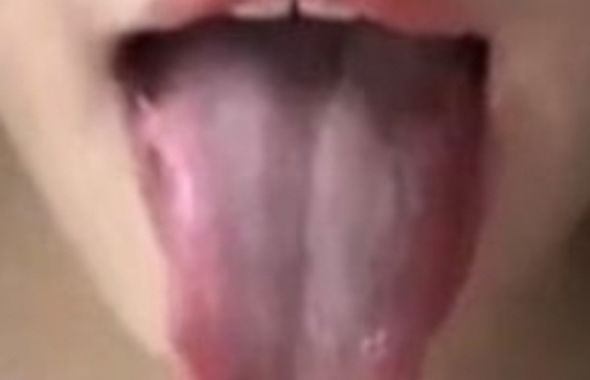 thumb