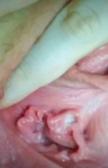 thumb