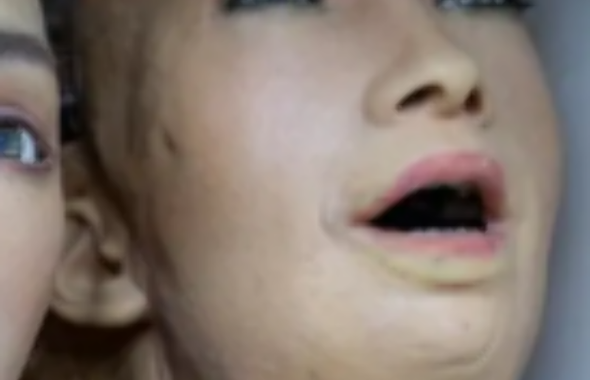 thumb