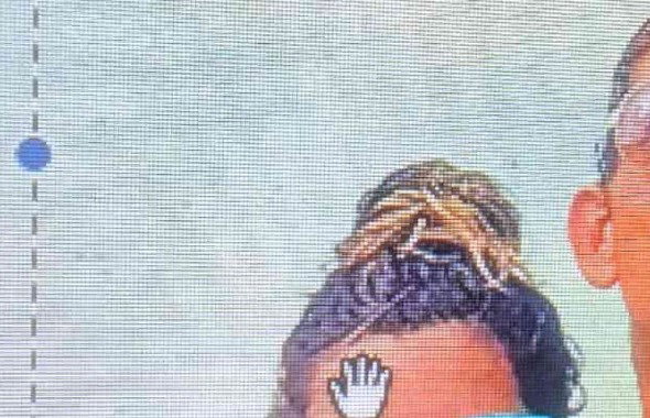 thumb